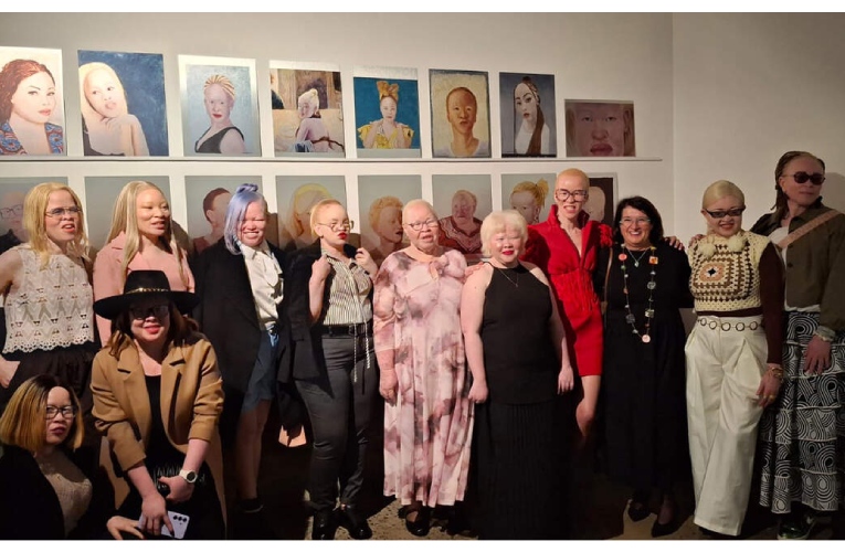 The Vanilla Sisters Lunch Club: Our Portraits, our Stories exhibition, a portraiture of the complex lives of people living with albinism